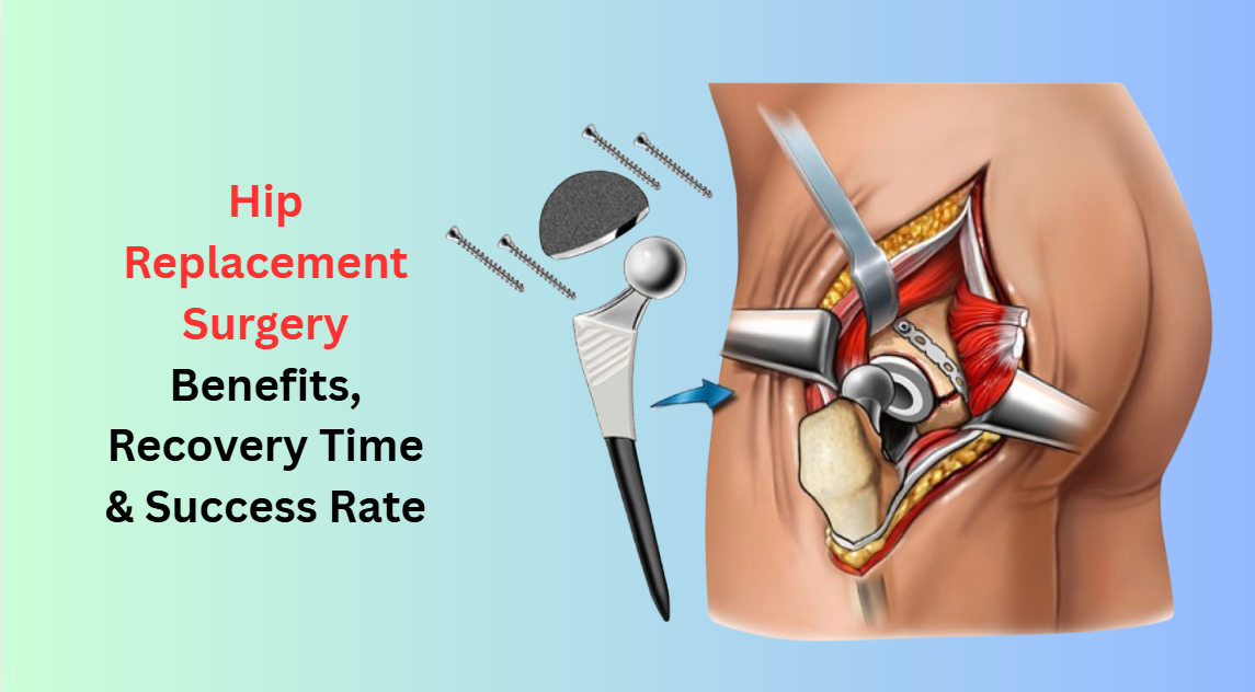 Hip Replacement Surgery: Benefits, Recovery Time & Success Rate